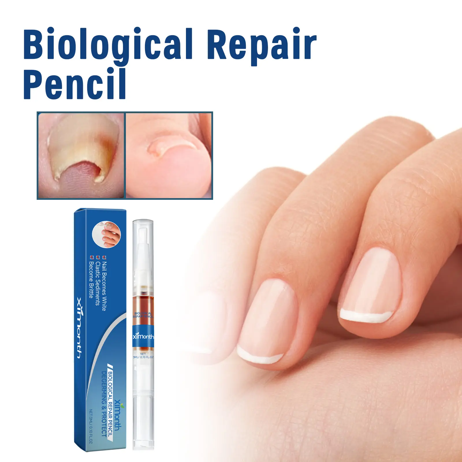 Ximonth Biological Repair Pencil, Hand, Foot And Nail Care Thickening Repair Soft Nail Insert Nail Bright Nail Nail Pen