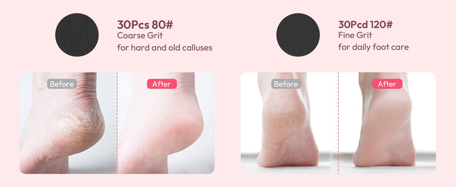 Electric Foot Callus Remover - 2 in 1 Rechargeable Electric Callus Remover for Feet, Pedicure Tools with 70pcs Sandpapers, Professional Foot Scrubber File for Dead Skin - Pink Electric Foot Callus Remover - 2 in 1 Rechargeable Electric Callus Remover for Feet, Pedicure Tools with 70pcs Sandpapers, Professional Foot Scrubber File for Dead Skin - Pink