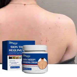 Herbal Folliculitis Treatment Cream for Soothing Itching and Redness, Healing Therapy Ointment for Face, Scalp, and Body, 20g
