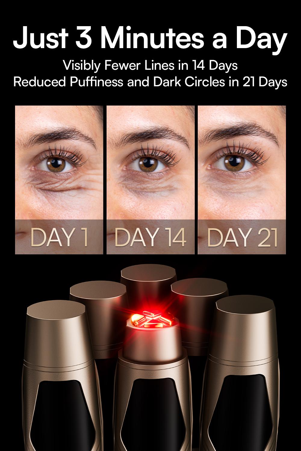 INIA LUMIN 4-in-1 Eye Skincare Wand – 3 Mins a Day for Fewer Lines in 14 Days & Less Puffiness in 21, FDA-Cleared, Spa-Level Results at a Fraction of the Price, Lift & Brighten Eyes in Just Weeks