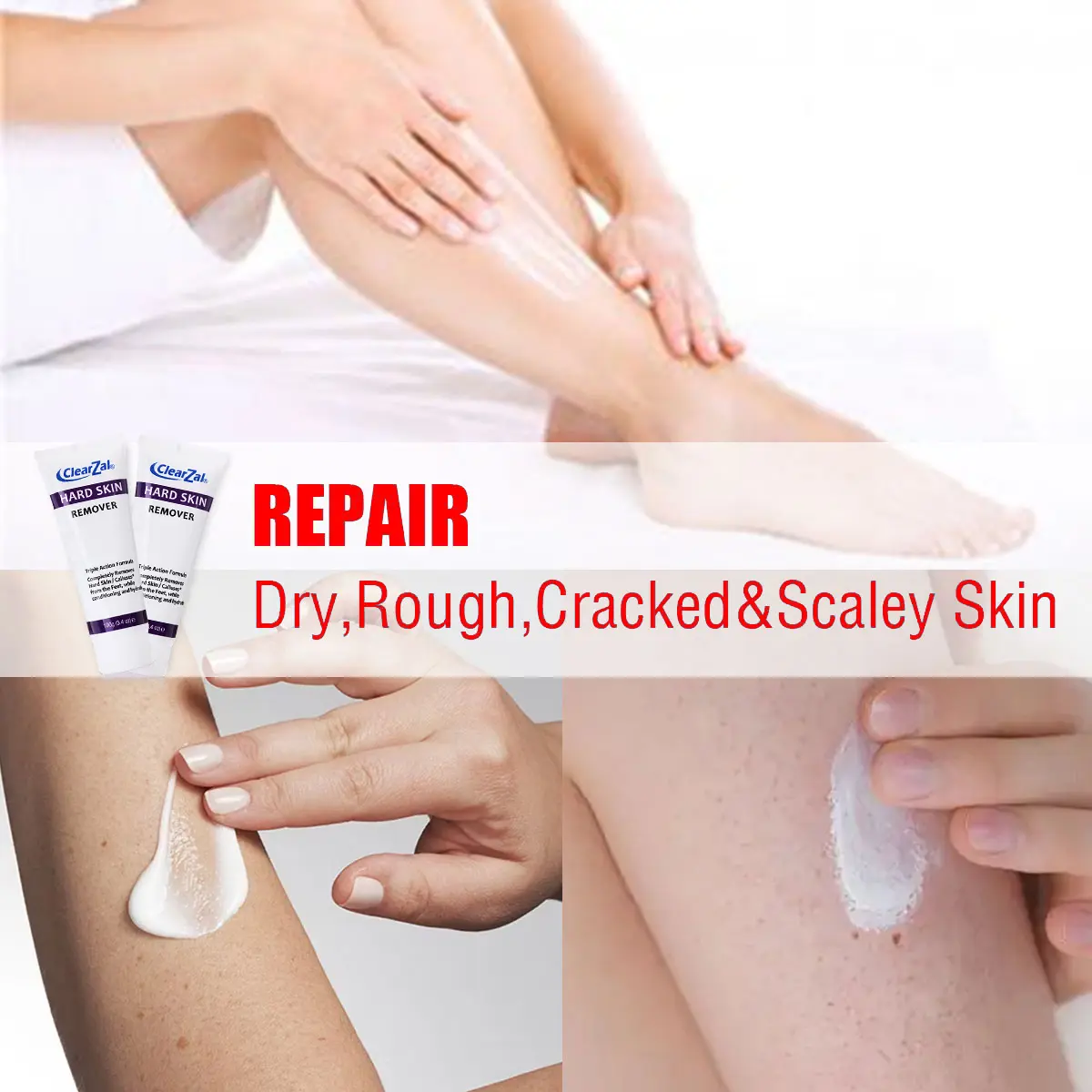 ClearZal targets chicken skin on arms and legs and enlarged pores,  improves it, and can be used all over the body Triple action formula exfoliates old skin cells 3.4 Ounce  Salicylic acid gently exfoliates dead skin cells