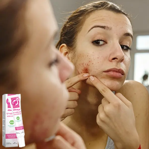 Skin Smoothing Treatment Moisturizer - Evens Out Skin Texture, Reduces Surface Spots, Moisturizers