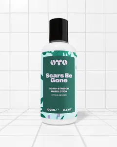 Scars Be Gone by OYO – Citrus-Infused Scar & Stretch Mark Lotion for Body, Face & Bikini Line, Brightening with Vitamin E & Lemon Peel Oil