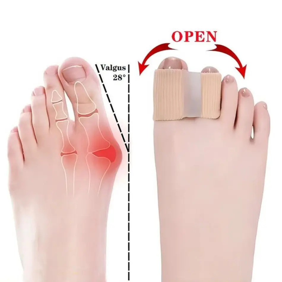 Silicone Bunion Corrector Sleeves and Toe Separators, 2-Piece Set for Bunion Relief and All-Day Comfort While Running and Hiking