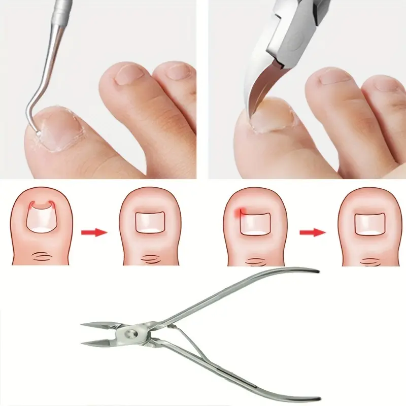3pcs/set  Ingrown Toe Nail Correction Nippers Clipper Cutters Dead Skin Dirt Remover, Paronychia Podiatry Pedicure Care Tool