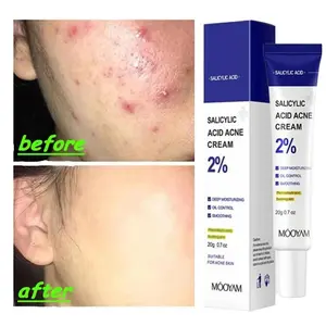 Salicylic Acid Acne Treatment Cream Acne Remover Face Cream Remove Deep Acne Scars Gel Oil Control Shrink Pores Blackheads Care