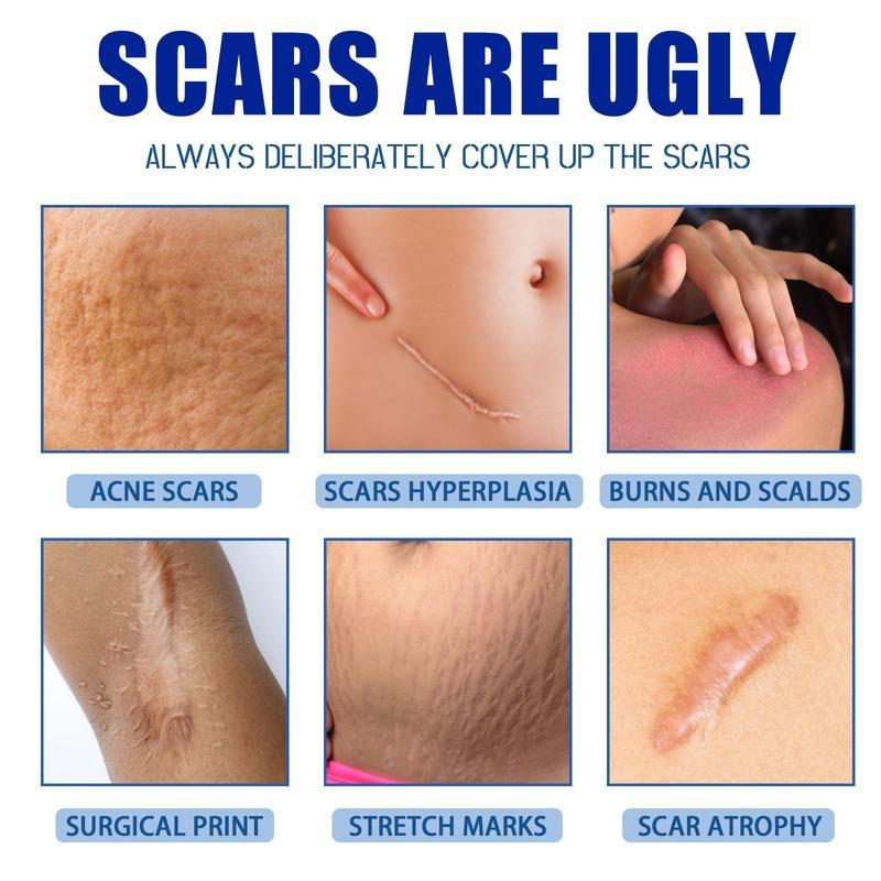 Professional Scar Removal Gels, Advanced Silicone Scar Removal Cream for Burn,Acne Old Scar Removal Cream for Face & Body | Fades Dark Scars
