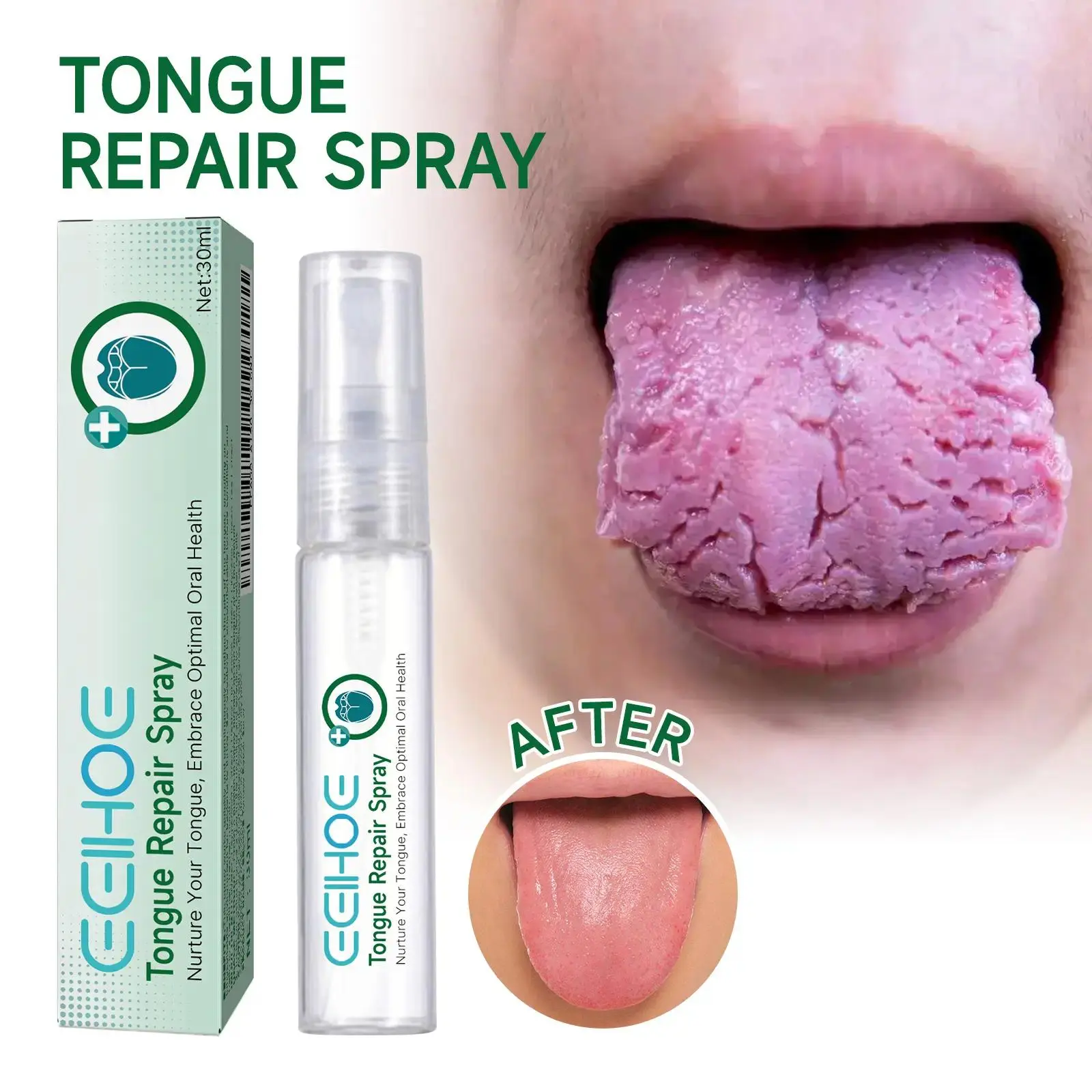 Oral Care Cleansing Spray - Unscented, Alcohol-Free, Non-Toxic Gentle Soothing Formula for Tongue Care (Cracked, Swollen Tongues), Mucosa Repair, Antibacterial, Deodorizing, Whitening, Long-Lasting Fresh Breath, Toothpaste Complement, Contains Neither, Da