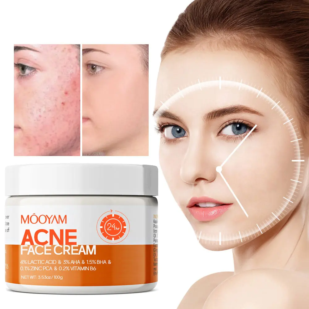 MOOYAM 100ml Acne Scar Cream - Centella Asiatica & Snail Extract Repair Treatment with Salicylic Acid, Fragrance-Free, Paraben-Free Skincare Remedy for Sensitive Skin Teenagers, Dark Spots, Hyperpigmentation, Fading Dark Spots