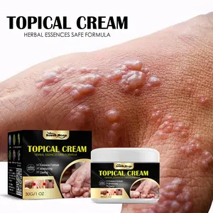South Moon Anti-Itch Care Cream for Sweat-Related Skin Irritation on Hands and Feet, Dry Itching Relief, Mosquito/Insect Bite Relief Care Cream