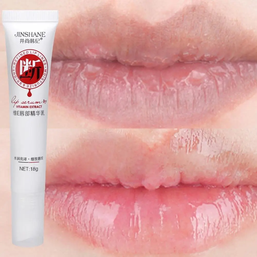 Remove Dark Smoke Lips Pink Fresh Lightening Bleaching Cream Treatment Lip Balm Moisturizer Nourishing Essence Lips