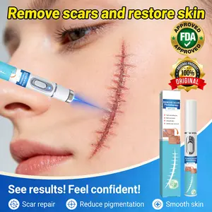 Daily Skin Renewal Laser Pen | Gently Improves Look of Post-Breakout Skin & Minor Imperfections | Non-Invasive Technology for Refreshed Complexion | Portable Personal Care Device