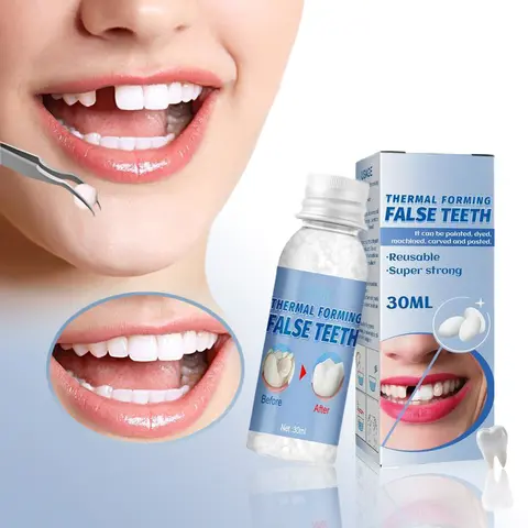 Denture Mouldable Kit, Moldable Dental Gel - Compact & Portable, Easy to Use for Adults, Emergency Temporary Tooth Filling, Anti-Cavity Repair, Denture Care, Quick Oral Restore with Shapeable Cover, No Harmful Additives