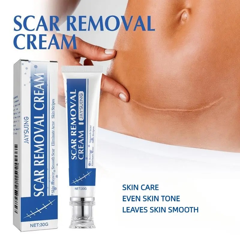 Scar Removal Skin Care Cream, Scar Repair Cream, Daily Gentle Hydrating Moisturizing Body Cream for Smoother, Tender & Refreshed Skin