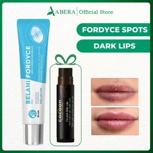 Fordyce Cream for Lips – Fordyce Spot Care, Lip Moisturizer & Repair Balm for Men, Helps Improve Dark Lips, Enriched with Nelupure & Shea Butter (0.7 Oz)