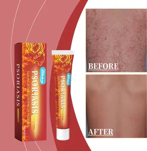 Therapeutic Skin Repair Ointment for Eczema, Psoriasis & Dermatitis - Moisturizing Antifungal Healing Cream for Tinea and Irritation Relief, Unisex