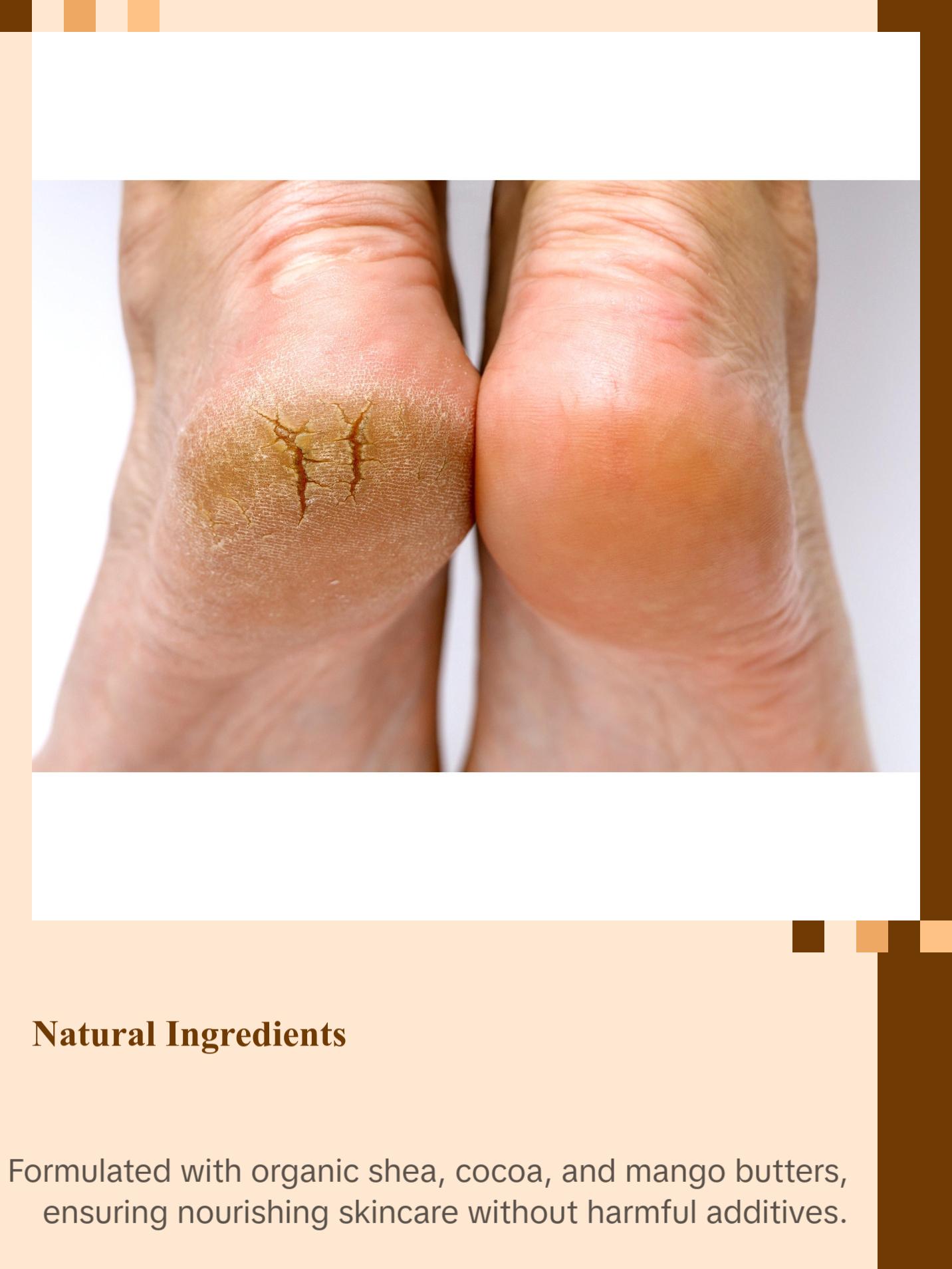 Sole Mates Foot Repair Butter