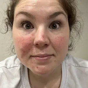 Product Review of [medicube] Affordable Glass Glow Skincare Set | Includes 8 products for Gentle Skin Glow Routine from M**a