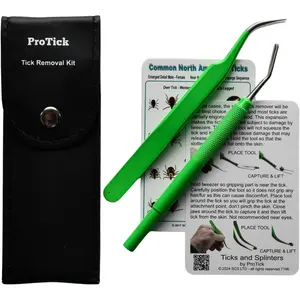 Tick Removal Kit, Precision Stainless Steel Tools, Carry Case, Tick ID Card, Removes All Tick Species and Sizes. Dog, Deer, Lone Star Ticks and Others Meet Their Match with This Premium Set
