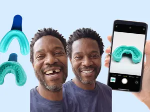 Klyros Custom removable Tooth Appliance - For upper or lower missing teeth, professionally made, custom fit to your mouth