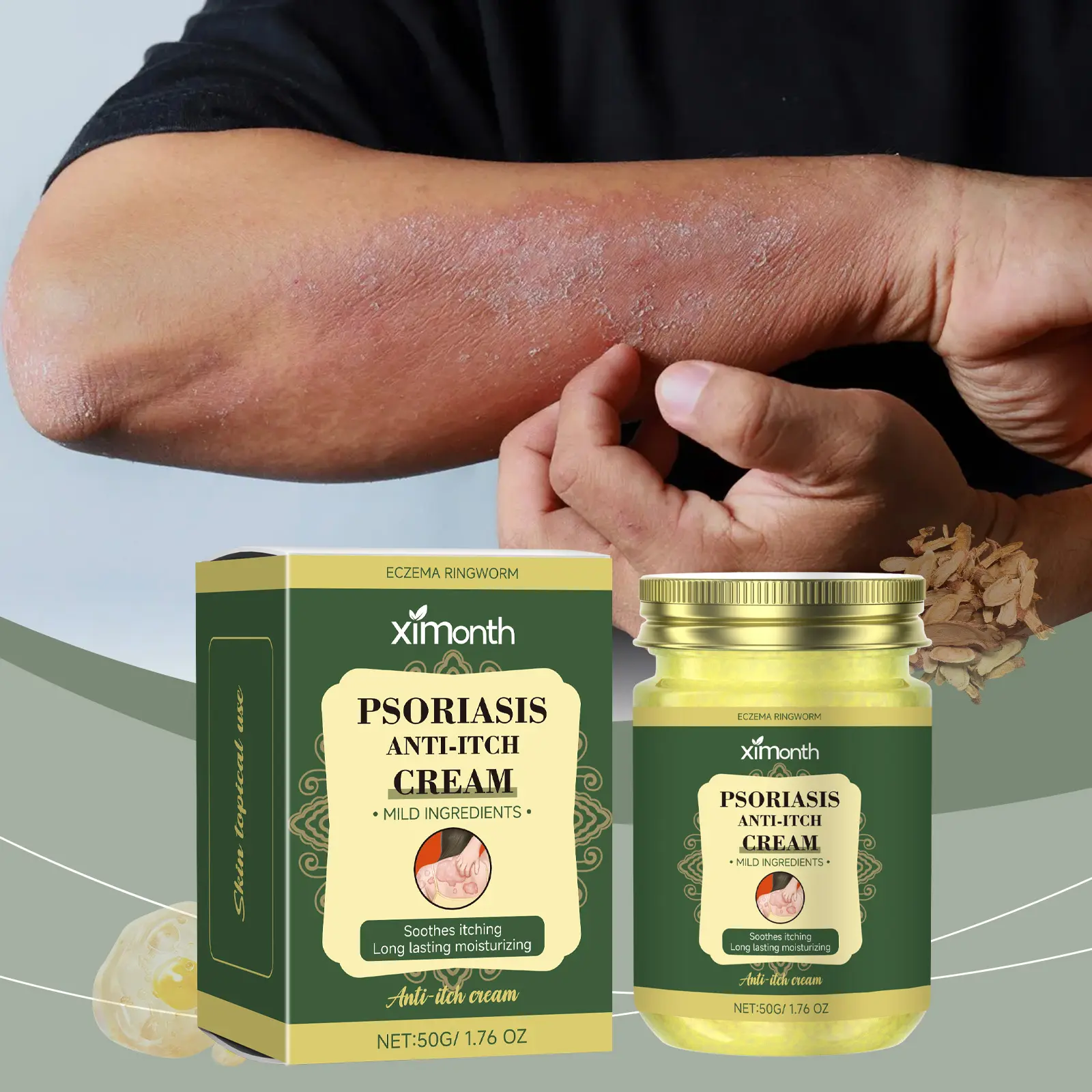 Ximonth Psoriasis Care Cream - Body Moisturizer for Relieving Skin Itching and Treating Ringworm (Beauty & Personal Care)