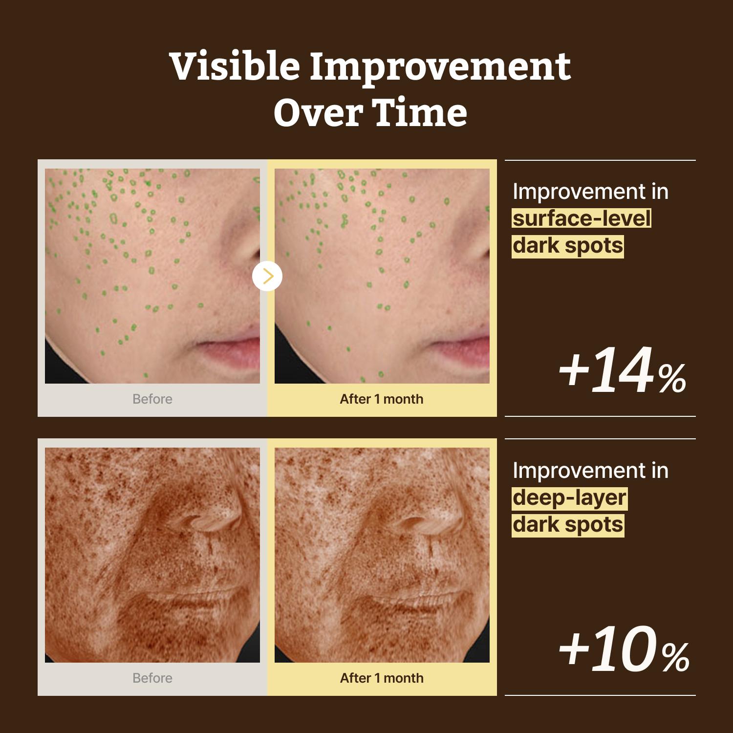 Dr.Reju-All Advanced Retino-Mela Serum – HPR Retinol Serum for Face – Anti-Aging, Pore Minimizer, Next-Gen Korean Skin care – Gentle & Beginner-Friendly – Niacinamide 10% & TXA 4% – 1 Fl Oz