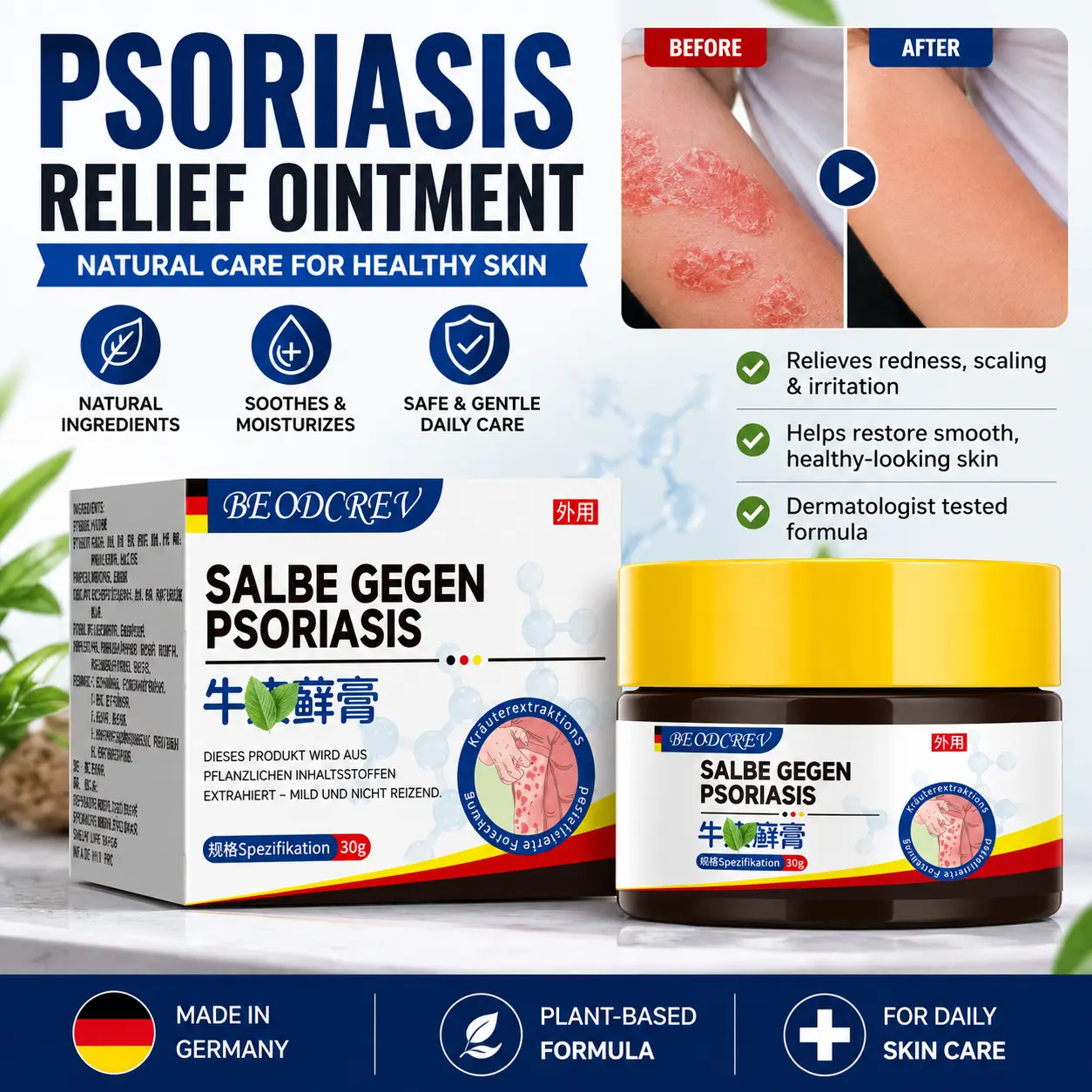 Psoriasis Treatment Cream with Honeysuckle & Menthol, Cooling Topical Soothing Ointment for Itch Relief and Care for Dry, Cracked Skin, Gel