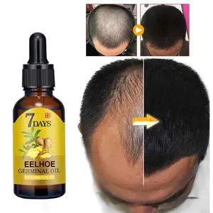 EELHOE Hair Growth Serum Ginger Extract Nourishing Scalp Treatment for Thicker Stronger Hair Care