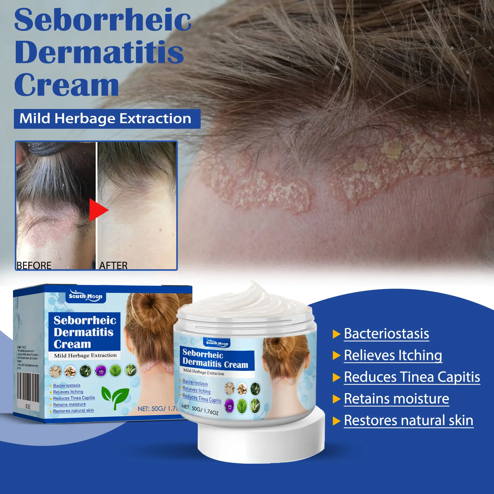 TrueRelief Folliculitis Treatment Cream -Natural Herbal Formula with Honeysuckle, Dandelion,Sophora & Phellodendron for Scalp, Face & Body Care,Soothing & Repairing 50g, Seborrheic Dermatitis Cream