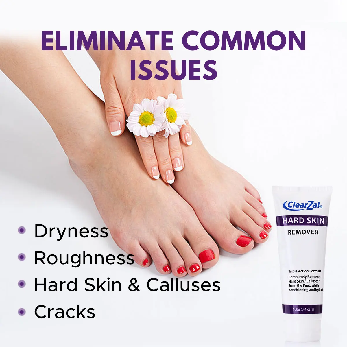 Clearzal Foot Cream For Hard Skin, Cream for Dry, ,Moisturizer for Dry Cracked Heels & Feet,Moisturizing Foot Cream, Guaranteed Relief for Extremely Dry, Cracked Feet, Rich in salicylic acid, menthol, urea, aloe vera, 3.4 Ounce Tube All Skin Types**