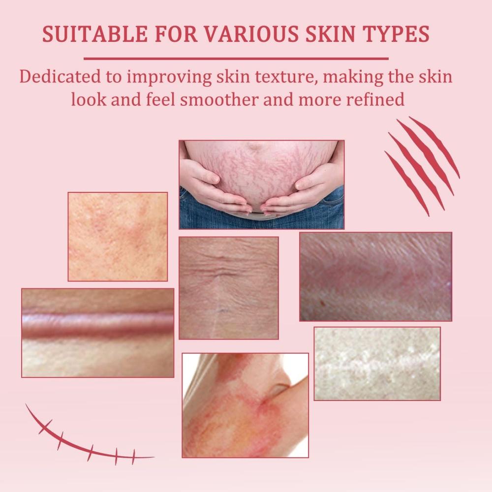 Scar Soothing Cream, Helps Improve Appearance of Scars, For Skin Recover Smooth, Lightweight Non-Greasy Formula