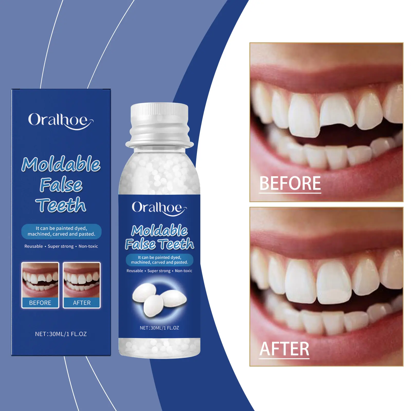 Moldable Tooth Repair Beads, Temporary Tooth Glue for Cosmetic Teeth & Smile Decor