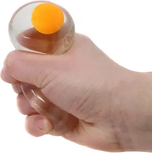 Funky Egg Splat Ball Squishy Toys | Stress Relief Eggs Yolk Balls Squishies Fun Toy for Children | Anxiety Reducer Sensory Play | Tension Relief
