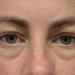 Product Review of Peter Thomas Roth Instant FirmX Easy Wear Temporary Eye Tightener (20ml) from e**i