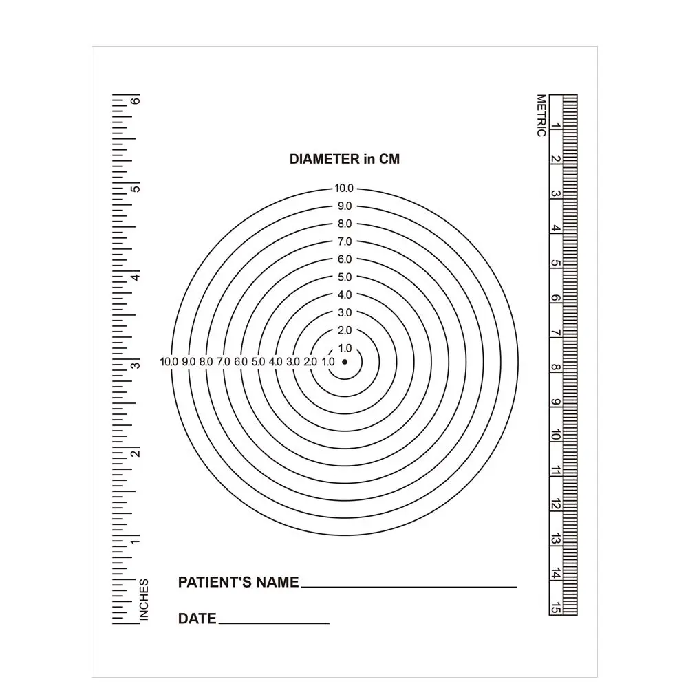 (Pack of 100) Wound Measurement Tools Wound Measuring Bullseye Guide Wound Measuring Ruler Medical Ruler Wound Measuring Tool Device Wound Measure Guide