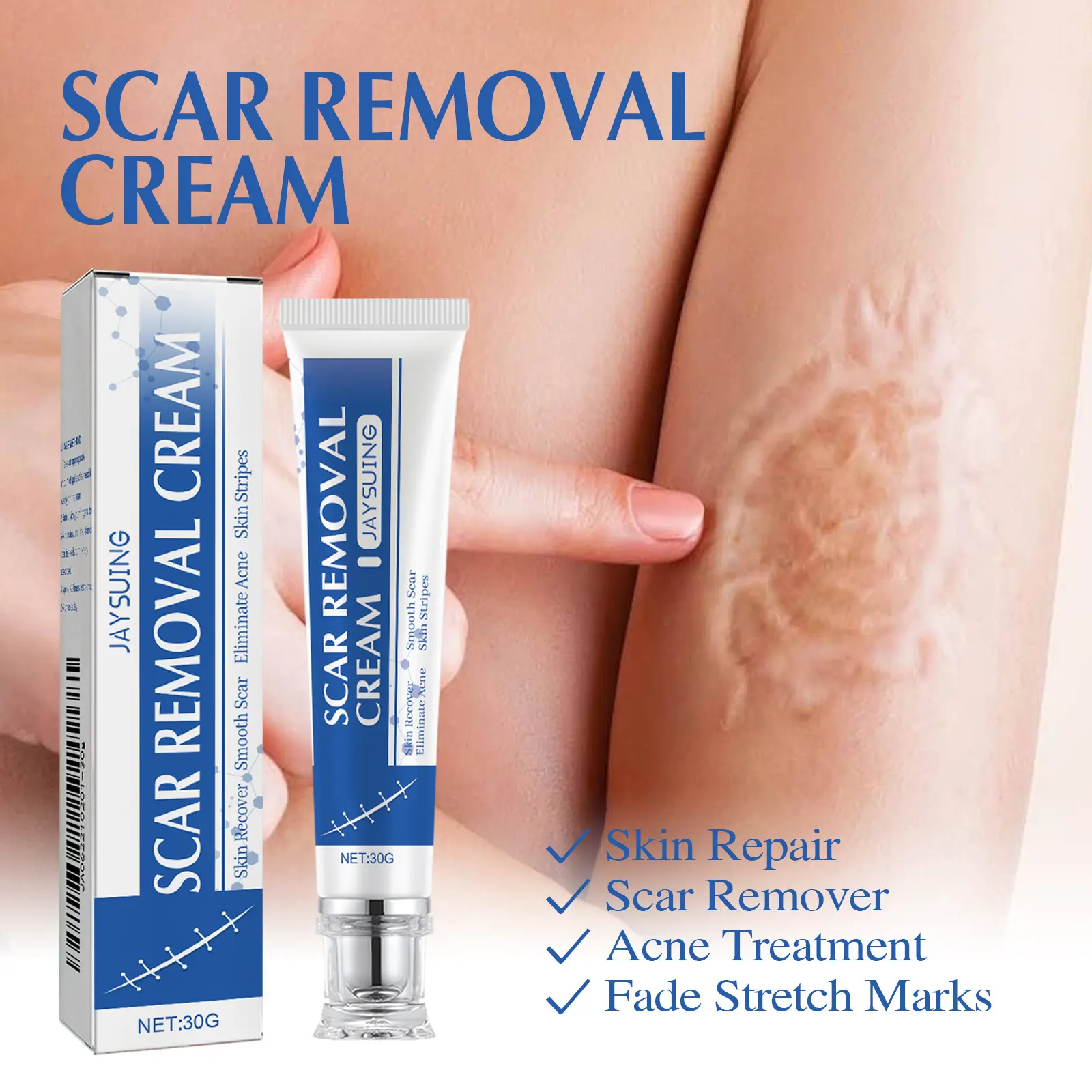 Scar Repair Cream for Old & New Surgical Scars, Stretch Marks & Acne - Gentle Treatment for Face & Body, 30g, Scar Cream For Surgical Scars