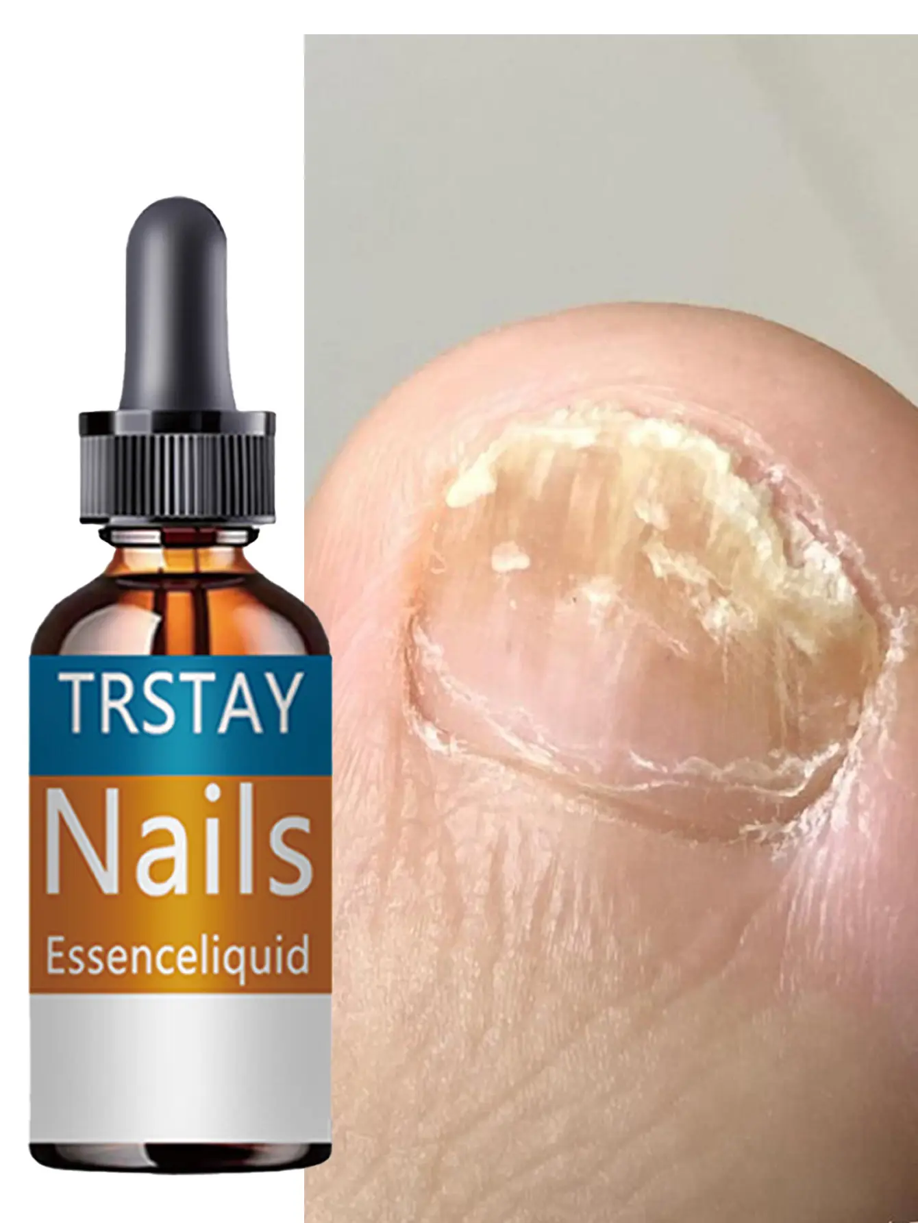 Hand and Foot Nail Care Essence with Shea Butter and Almond Oil, Moisturizing Care for Dry Cuticle Area and Smooth Looking Nails, Youth, Liquid, Moisturizer, Daily Routine, Easy Apply, Conditioning, Bedtime Nail Care