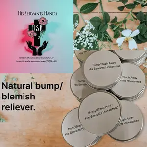 His Servants Hands Natural Bump Staph Away - Natural Blemish Reliever for Body Care Moisturizer from His Servants Homestead Skin Repair