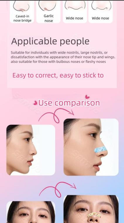 Memory keel high nose bridge patch, molds as you like, fits without harming the skin, adjustable, corrects in one use, disposable nasal wing and nose bridge patch