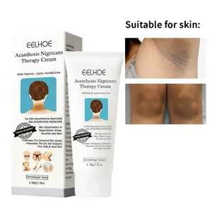 EELHOE Skin Care Cream for Brightening, Nape, Elbows, Knees, Knuckles & Back, Moisturizing Body Care for Women & Men, Body Butter  Moisturizer  Gift Lotion Discoloration Radiance Moisture Hydrating Cosmetic body glaze girl products for body