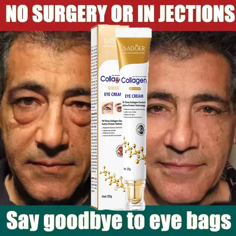 Collagen Eye Repair Cream - Skin Firming & Lifting Treatment, Reduces Dark Circles, Wrinkles, Puffiness, Bags, Fine Lines, Boosts Bright Undereye Skin, Eye Cream For Puffiness And Bags Under Eyes