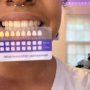 【CEELIKE】 Purple Teeth Whitening Strips, Daily Brightening, with Free Cheek Retractor - 7/21 Sessions - Nano-Hydroxyapatite for Dental Enamel Care, Bioactive Enamel-Safe, Peroxide-Free, Non-Sensitive