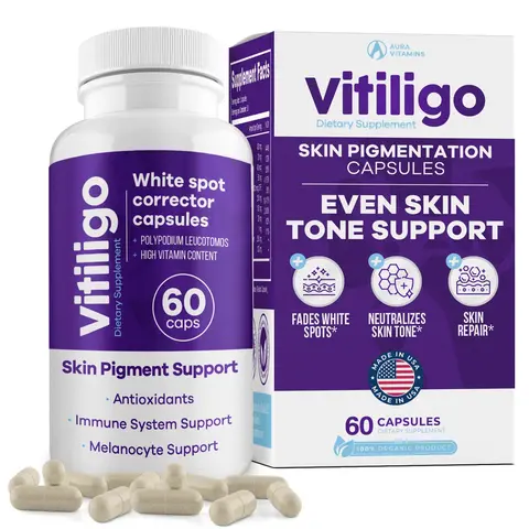 AURA VITAMINS - Vitiligo Capsules 60 Count | 1 Month | Improve Skin Pigmentation Support and Reduce White Spots | Effective Vitiligo Supplement | Natural Solution for White Spots on Skin. (1)