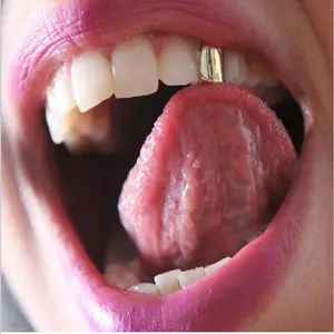 Hip-Hop Gold Tooth Cap – Single-Tooth, Real-Gold-Plated Hip-Hop Dental Jewelry