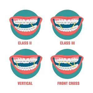 Braces elastics OrthodentalUSA Corp Extra Heavy Orthodontic Intraoral Elastics 10 Pack x 100pcs 3/16" 8 oz 4.7mm Surgical Latex for Class II III Vertical Front Cross Orthodontics Made in USA Correction Tools Stainless Wire Brace Teeth Braces