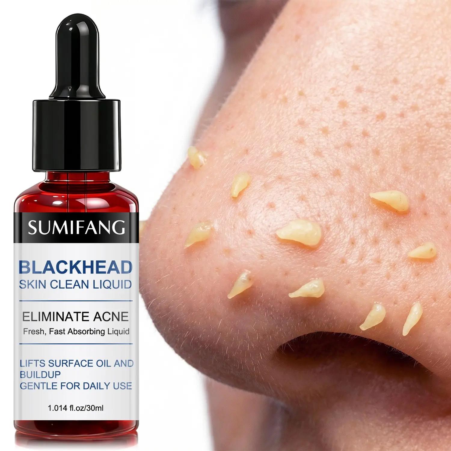 SUMIFANG Blackhead Cleansing Solution 30ml Serums, Blackhead Remover Serum, Blemish Control, Acne Essence, Salicylic Acid + Succinic Acid + Lactobionic Acid + Niacinamide dissolves blackheads, eliminates acne, cleanses oil, tightens pores