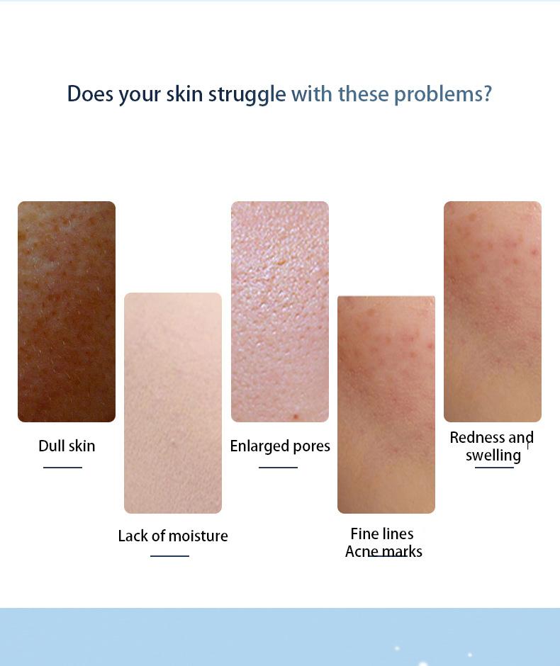 Ice compress small ice hammer cold compress instrument face girl ice muscle beauty instrument soothing edema gift