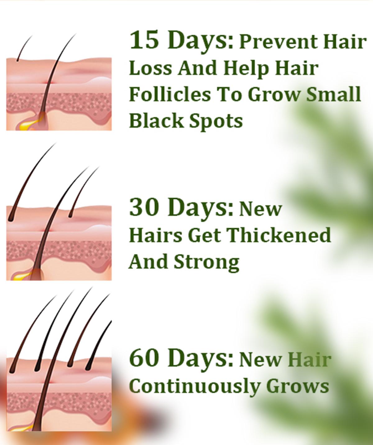 [mothersdaygift] Batana  Essential Oil for promoting Hair Growth，Organic Rosemary Batana Oil Nourish Scalp,for all hair types,Anti Hair Loss Repair Damaged Hair, Haircare Moisturizing.