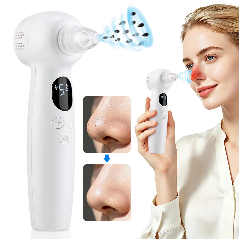 Electric Blackhead Remover Vacuum - Skin Care Tools, Facial Beauty Instrument, Pimple Popping Skin Care Device with Hot Compress, 5 Suction Levels, 3 Heat Settings for Whiteheads, Excess Oil, Clogged Pores