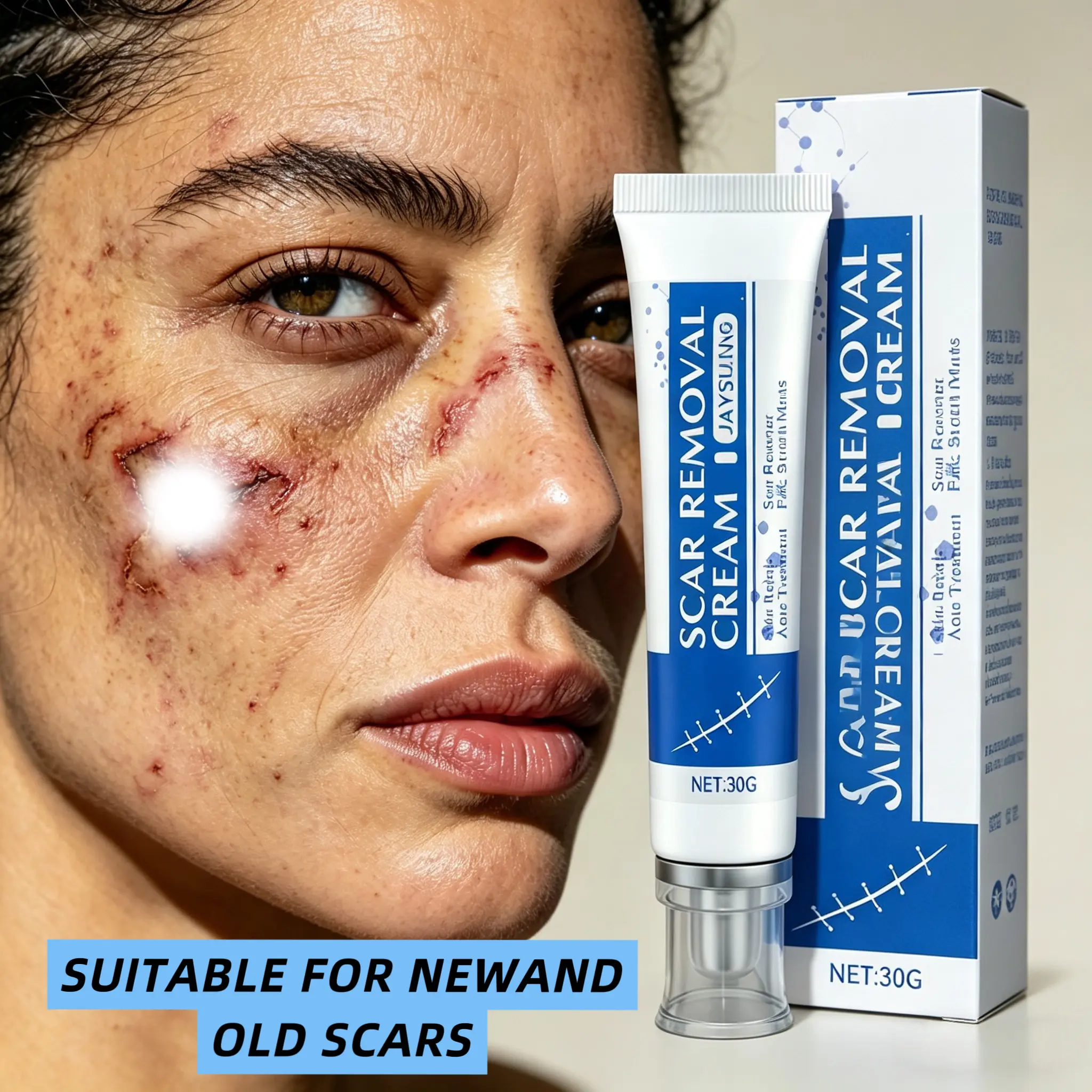 Scar Care Cream for Old & New Marks – Gentle Skin Moisturizer for Face & Body, Helps Improve the Look of Surgical, Acne & Injury Scars, Lightweight Non-Greasy Formula for Daily Use, 30g